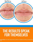 O'Keeffe's Cooling Relief Lip Repair Lip Lips,