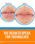 O'Keeffe's Cooling Relief Lip Repair Lip Lips,