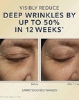 RoC Retinol Correxion Deep Wrinkle Night Cream 1.0 fl oz (30 ml)
