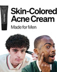 FRONTMAN Fade, Men's Acne Concealer With Salicylic Ac