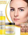 Turmeric Glow Combo Skincare Set, Turmeric