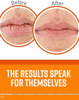 O'Keeffe's Unscented Lip Repair Lip Balm
