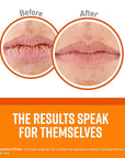 O'Keeffe's Unscented Lip Repair Lip Balm