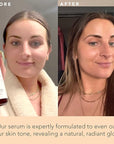 Face Tanner Serum - Fair to Medium Sunless Tanner for Face Sunless Tanner with Hyaluronic Acid - Self Tanner for Face Self Tan - Natural Face Tanner for Face Self Tanner