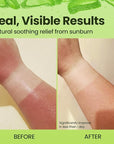Honeyskin Soothing Aloe Vera Gel Made in the USA with Natural Ingredients - Give Yourself Relief From Sunburn and Dry Skin During the Hot Summer Days (8 Fl Oz)