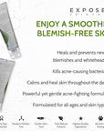 Exposed Skin Care Acne Treatment Serum