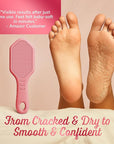 Silicone Foot Callus Remover - Nano Glass Foot File for Dead Skin and Cracked Heels - Callus Remover for Feet & Hard Skin - Ergonomic Foot Scrubber & Exfoliator for Soft, Smooth Feet - Pink