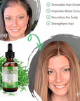 Rosemary Oil for Hair Growth, 100% Natural Cold Pressed Rosemary Hair Oil, Multipurpose Rosemary Essential Oils for Skin, Aromatherapy for Women & Men