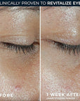 RoC Multi Correxion Revive + Glow Vitamin C Eye Balm (0.14 oz) with Retinol Eye Cream Packette