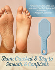 Silicone Foot Callus Remover - Nano Glass Foot File for Dead Skin and Cracked Heels - Callus Remover for Feet & Hard Skin - Ergonomic Foot Scrubber & Exfoliator for Soft, Smooth Feet - Blue