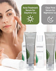 Exposed Skin Care Expanded Acne Treatment Clearing