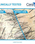 CeraVe 2 In 1 Hydrating Anti Dandruff Shampoo And Conditioner, 1% Pyrithione Zinc Dandruff Treatment, Color Safe & Sulfate Free Shampoo And Conditioner, Helps Eliminate Dandruff & Relieve Itchy Scalp