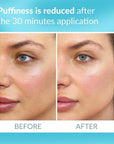 Talika eye therapy patch -