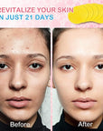Turmeric Cleansing Pads, Kojic Acid Cleansing Pads - Gentle and Effective Daily Skincare for Face and Body