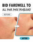 Pore Refining Serum | Pore Minimizing Serum for Face | Organic Face Moisturizer Pore Tightening Serum | Hydrating Face Serum Pore Minimizer Korean Skin Care Products (1.01 Fl. Oz)