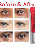 Retinol eye cream for anti-aging: