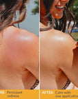 After Sun Cooling Aloe Vera Spray - USA Made With Organic Aloe Vera, Fast Absorbing After Sun Care for Sunburn Relief, Skin Cooling After Sun Spray, Sunburn Treatment Spray Lotion for Body