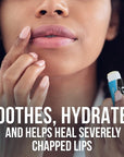 ChapStick Classic Medicated Lip Balm Tubes,