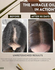 Batana Oil for Hair Growth - 2oz - 100% Pure, Cold Pressed, Unrefined Oil from Honduras - Supports Stronger & Thicker Hair - Dr Sebi Inspired Hair Growth Treatment