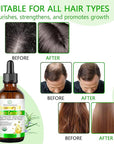 Rosemary & Castor Hair Growth Oil – USDA Certified Organic Cold Pressed Blend Castor oil for Thicker, Fuller Hair, Soothe Itchy Scalp & Repair Damaged Hair – 4 fl oz
