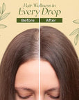 Natural Hair Growth Oil for Women infused with 10 Premium Botanic Oils plus Organic Rosemary Oil for Hair Growth | Salon-Grade Volumizing & Nourishment | Non-GMO Verified | 30-Day Supply
