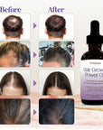 Rosemary Oil With Black Castor, Batana, Lavender, Coffee, Coconut, Argan, Avocado, Olive, Almond & Parsley Seed Oil, 11 Oils Infused for Ultimate Hair Growth & Care for Stronger, Thicker Hair