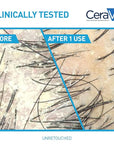 CeraVe Hydrating Anti Dandruff Conditioner, 0.5% Pyrithione Zinc Dandruff Treatment With Ceramides, Hyaluronic Acid & Niacinamide, Helps Eliminate Flakes & Reduce Itchy Scalp, Sulfate Free Conditioner