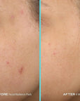 First aid beauty facial radiance