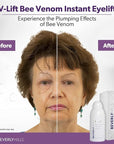 Beverly Hills V-Lift Instant Eye Lift and Eye Tuck Bee Venom Serum for Puffy Eyes, Dark Circles, Wrinkles, and Under Eye Bags Treatment for Women and Men | 30mL (120 Day Supply)