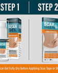 Scar Sheets Light Tone 4 Pack