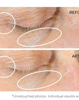 Strivectin anti-wrinkle intensive eye cream