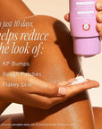 First Aid Beauty - KP Smoothing + Brightening Body Lotion with 10% AHA, Lactic Acid, Urea + Colloidal Oatmeal, Exfoliate + Moisturize, Banish Keratosis Pilaris Bumps, NEW Peach Scent (6. 7 fl oz)