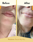 ECZEMA HONEY Nourishing Lip Balm -