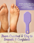 Silicone Foot Callus Remover - Nano Glass Foot File for Dead Skin and Cracked Heels - Callus Remover for Feet & Hard Skin - Ergonomic Foot Scrubber & Exfoliator for Soft, Smooth Feet - Purple