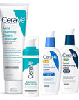 CeraVe Acne Skin Care Set, 5oz Acne Foaming Cream Cleanser + 1oz Resurfacing Retinol Serum + 2oz AM Facial Moisturizing Lotion with SPF 30 + 2oz PM Facial Moisturizing Lotion