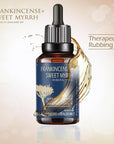 BALM OF GILEAD Neuropathy Frankincense & Sweet Myrrh Therapeutic Rubbing Oil - Instant Diabetic's & Autoimmune Dry Skin Relief & Repair, 2 fl oz