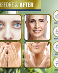 Advanced Clinicals Retinol Cream Face Moisturizer Sagging