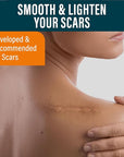 Scar Sheets Light Tone 4 Pack