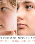 Bio Retinol Alternative Bakuchiol Serum - Smooths Skin & Reduces Fine Lines, USA Made with Natural & Organic Ingredients, Anti-Aging Skin Care Formula, Vegan, Cruelty Free