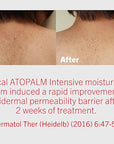 ATOPALM | Intensive Moisturizing Cream | Face & Body Moisturizer | For Dry & Sensitive Skin | Paraben-Free Lotion | Replenishes Hydration | Skin Barrier Repair | Korean Skin Care | 3.4 fl oz (100ml)