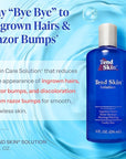 Tend Skin Solution for Unsightly Razor Bumps, Ingrown Hair and Razor Burns, Post Shaving and Waxing Toner for Men and Women, Made in USA, 8 Oz