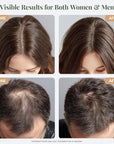 The ÉLIX USDA Organic Rosemary Oil for Hair Growth | Thickening Formula with Castor & Pumpkin Seed | for Hair Loss & Thinning | Made in USA | 4oz