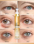 Caffeine eye serum for dark