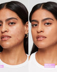 Revlon Illuminance Tinted Serum, Triple Hyaluronic Acid, Evens Out Skin Tone Over Time and Hydrates All Day, SPF 15, 405 Hazel, 0.94 fl oz.