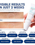 Re.SPN Bakuchiol Firming Roller Eye Cream – For Puffy Eyes, Wrinkles & Dark Circles with Gua Sha Applicator, Vegan, Natural Retinol, Niacinamide, K-Beauty (0.67 fl oz)