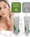 Exposed Skin Care Basic Acne Treatment Clearing