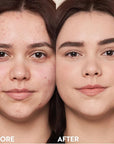 M. Asam Magic Finish Make-Up Mousse (1.01 Fl Oz) – 4in1 Primer, Foundation, Concealer & Powder With Buildable Coverage, Hides Redness And Dark Spots, Vegan, For Light To Medium Skin Tones