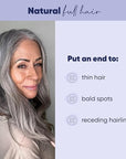 MOERIE Ultimate Hair Growth Serum for Natural Hair Regrowth & Thickening - Anti Thinning & Hair Loss Treatment for Women - Rapid Hair Growth Products - Scalp Oil Alternative - 1.69 fl oz / 50 ml