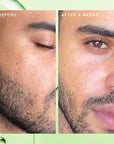 Farmacy 2% Salicylic Acid Toner Healthy-Looking