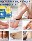 Urea Cream 60% Foot Balm Stick for Cracked Heels - Moisturizes, Exfoliates, and Softens Dry, Thickened Skin, Callus Remover for Feet(40g x 2 Pack)